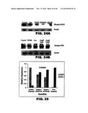 TARGETING EN2, PAX2, AND/OR DEFB1 FOR TREATMENT OF PROSTATE CONDITIONS diagram and image