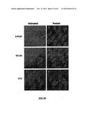 TARGETING EN2, PAX2, AND/OR DEFB1 FOR TREATMENT OF PROSTATE CONDITIONS diagram and image