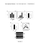 Method For Treatment Of Macular Degeneration By Modulating P2Y12 or P2X7     Receptors diagram and image