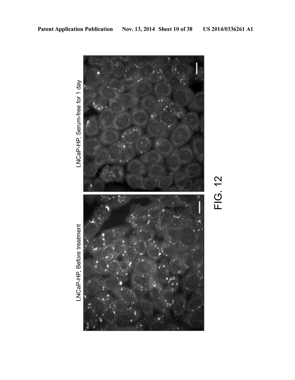 METHODS FOR DETERMINING AGGRESSIVENESS OF A CANCER AND TREATMENT THEREOF - diagram, schematic, and image 11