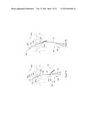 SYSTEMS AND METHODS EMPLOYING A PUSH TUBE FOR DELIVERING A URETHRAL SLING diagram and image