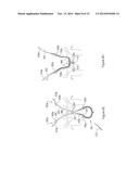 SYSTEMS AND METHODS EMPLOYING A PUSH TUBE FOR DELIVERING A URETHRAL SLING diagram and image