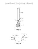 APPARATUS AND METHODS FOR HYBRID ENDOSCOPIC AND LAPAROSCOPIC SURGERY diagram and image