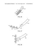 APPARATUS AND METHODS FOR HYBRID ENDOSCOPIC AND LAPAROSCOPIC SURGERY diagram and image