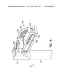 METHOD OF RETRACTING BODY TISSUE DURING SURGERY diagram and image