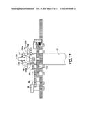 METHOD OF RETRACTING BODY TISSUE DURING SURGERY diagram and image