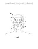 DEVICES AND METHODS FOR THE RAPID AND ACCURATE DIAGNOSIS AND TREATMENT OF     SINUSITIS diagram and image