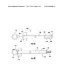 DEVICES AND METHODS FOR THE RAPID AND ACCURATE DIAGNOSIS AND TREATMENT OF     SINUSITIS diagram and image