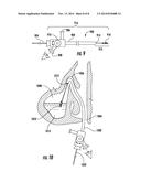 DEVICES AND METHODS FOR THE RAPID AND ACCURATE DIAGNOSIS AND TREATMENT OF     SINUSITIS diagram and image