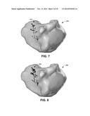 ANALYSIS AND DETECTION FOR ARHYTHMIA DRIVERS diagram and image