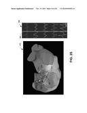 ANALYSIS AND DETECTION FOR ARHYTHMIA DRIVERS diagram and image