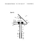 FISTULA CATHETER diagram and image