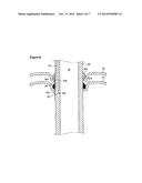 FISTULA CATHETER diagram and image