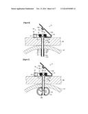 FISTULA CATHETER diagram and image