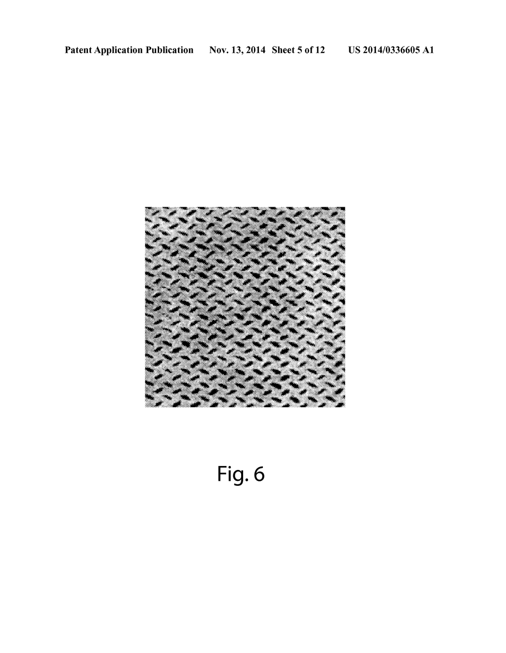 Apertured Nonwoven Materials and Methods For Forming The Same - diagram, schematic, and image 06