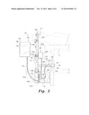 SKULL CLAMP SYSTEM WITH PRESSURE LIMITED AND ALARM SYSTEMS diagram and image