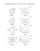 OSCILLATING LITHOTRIPTER diagram and image