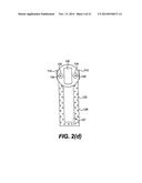 TISSUE FASTENING DEVICES AND PROCESSES THAT PROMOTE TISSUE ADHESION diagram and image