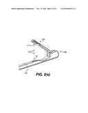 TISSUE FASTENING DEVICES AND PROCESSES THAT PROMOTE TISSUE ADHESION diagram and image