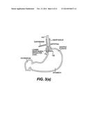 TISSUE FASTENING DEVICES AND PROCESSES THAT PROMOTE TISSUE ADHESION diagram and image