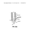 TISSUE FASTENING DEVICES AND PROCESSES THAT PROMOTE TISSUE ADHESION diagram and image