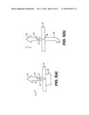 TISSUE FASTENING DEVICES AND PROCESSES THAT PROMOTE TISSUE ADHESION diagram and image