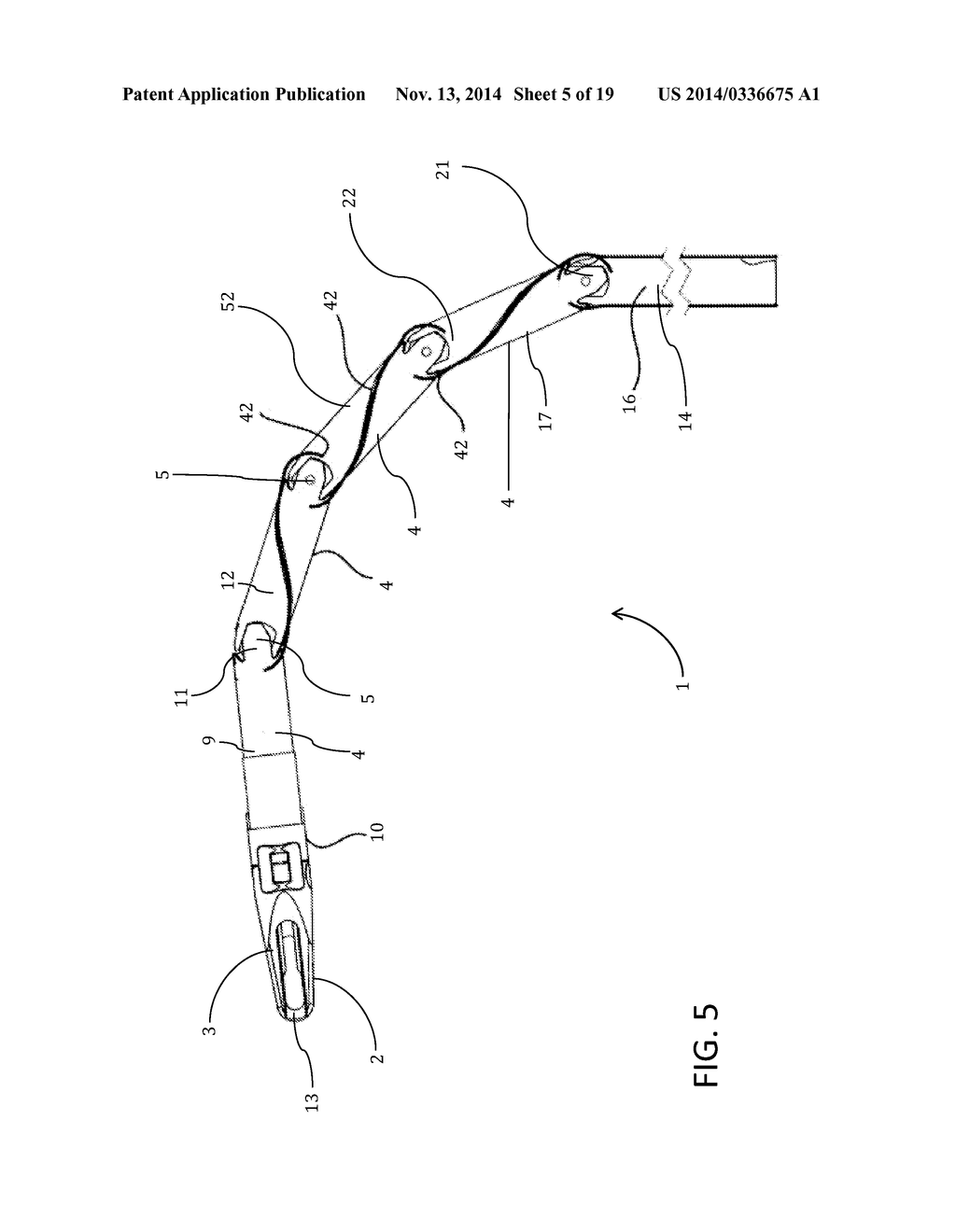 Articulating Steerable Clip Applier for Laparoscopic Procedures - diagram, schematic, and image 06