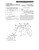 Occluding Catheter and Dynamic Method for Prevention of Stroke diagram and image