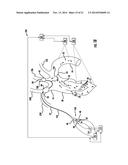 Occluding Catheter and Dynamic Method for Prevention of Stroke diagram and image