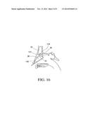 BALLOON CATHETERS AND METHODS FOR TREATING PARANASAL SINUSES diagram and image