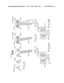 PERIPROSTHETIC BONE PLATES diagram and image