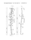 PERIPROSTHETIC BONE PLATES diagram and image