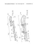 PERIPROSTHETIC BONE PLATES diagram and image