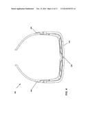 ACTIVE GLASSES FOR OPTIC NERVE STIMULATION diagram and image