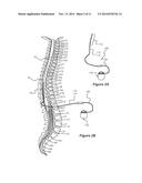 FRACTIONALIZED STIMULATION PULSES IN AN IMPLANTABLE STIMULATOR DEVICE diagram and image