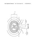 FRACTIONALIZED STIMULATION PULSES IN AN IMPLANTABLE STIMULATOR DEVICE diagram and image