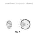 POROUS DEALLOYED ELECTRODES diagram and image