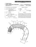 INTRALUMINAL VASCULAR PROSTHESIS diagram and image