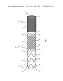 INTRALUMINAL VASCULAR PROSTHESIS diagram and image