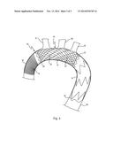 INTRALUMINAL VASCULAR PROSTHESIS diagram and image