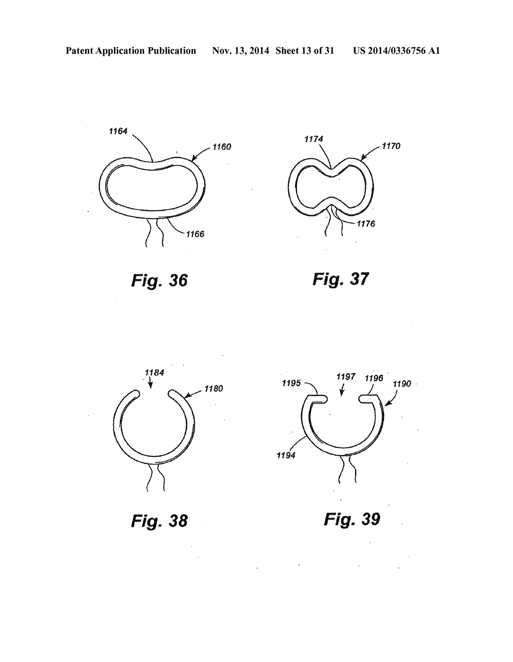 METHODS AND APPARATUS FOR CONTROLLING THE INTERNAL CIRCUMFERENCE OF AN     ANATOMIC ORIFICE OR LUMEN - diagram, schematic, and image 14