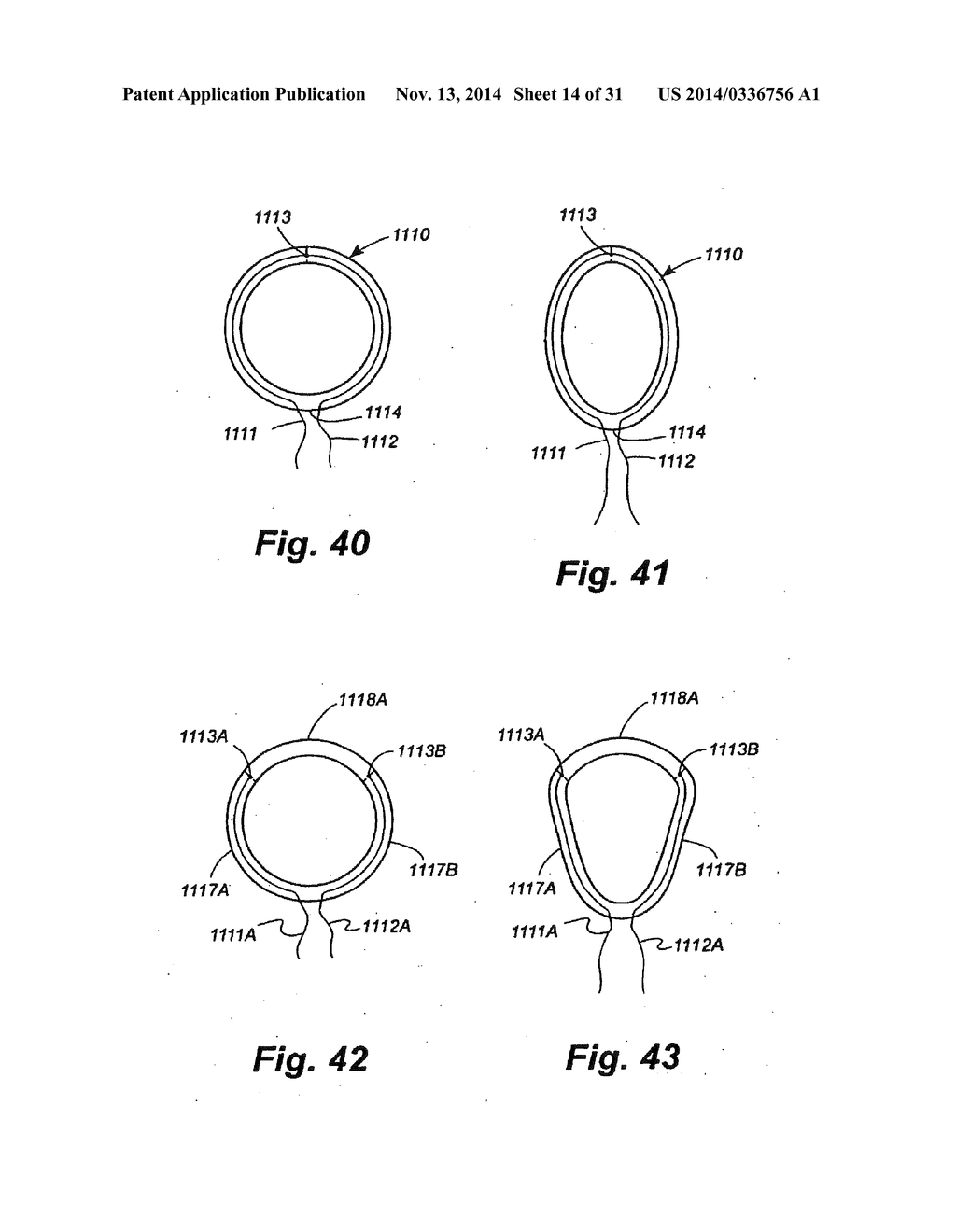 METHODS AND APPARATUS FOR CONTROLLING THE INTERNAL CIRCUMFERENCE OF AN     ANATOMIC ORIFICE OR LUMEN - diagram, schematic, and image 15