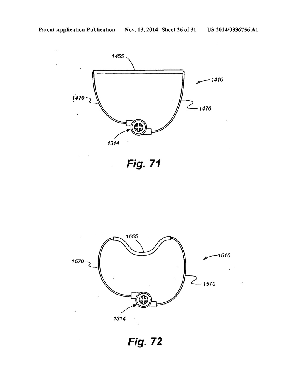 METHODS AND APPARATUS FOR CONTROLLING THE INTERNAL CIRCUMFERENCE OF AN     ANATOMIC ORIFICE OR LUMEN - diagram, schematic, and image 27