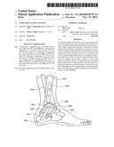 ANKLE REPLACEMENT SYSTEM diagram and image