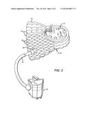 FACIAL PROTECTION AND THERMOREGULATION FOR PATIENTS UNDERGOING SURGERY diagram and image