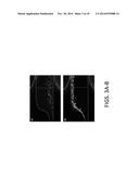 DIELECTROPHORESIS METHODS FOR DETERMINING A PROPERTY OF A PLURALITY OF     CANCER CELLS diagram and image