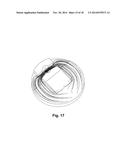 DOUBLE ENTRY CHANNEL LADLE BOTTOM diagram and image