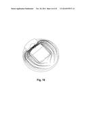 DOUBLE ENTRY CHANNEL LADLE BOTTOM diagram and image