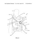 MOBILE CAMERA POINT OF VIEW MOUNT diagram and image