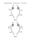 SYSTEM AND METHOD FOR SECURING HEADPHONE TRANSDUCERS diagram and image